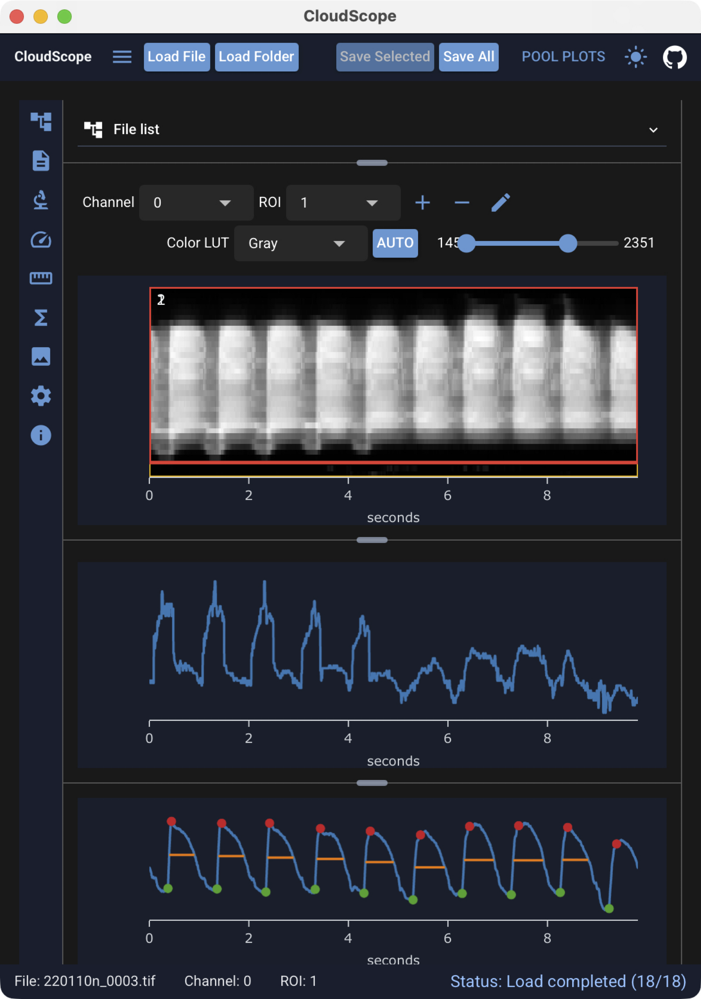 CloudScope Home page — file list, kymograph viewer, and analysis plots